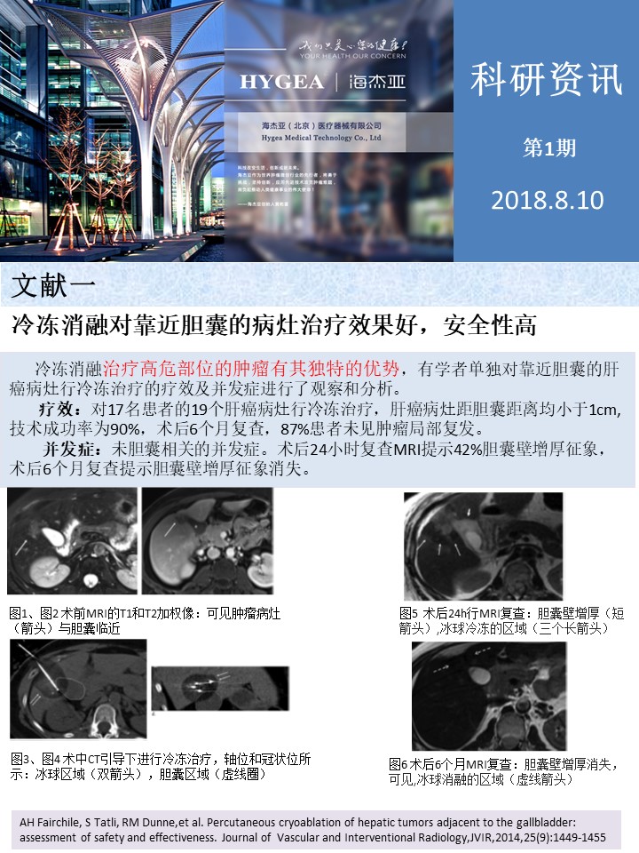 【海杰亞科研資訊】第1期——肝、肺癌消融
